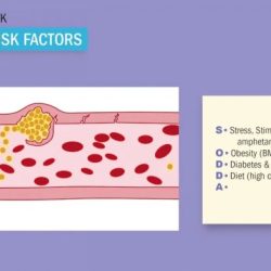 Acute coronary syndrome nclex questions